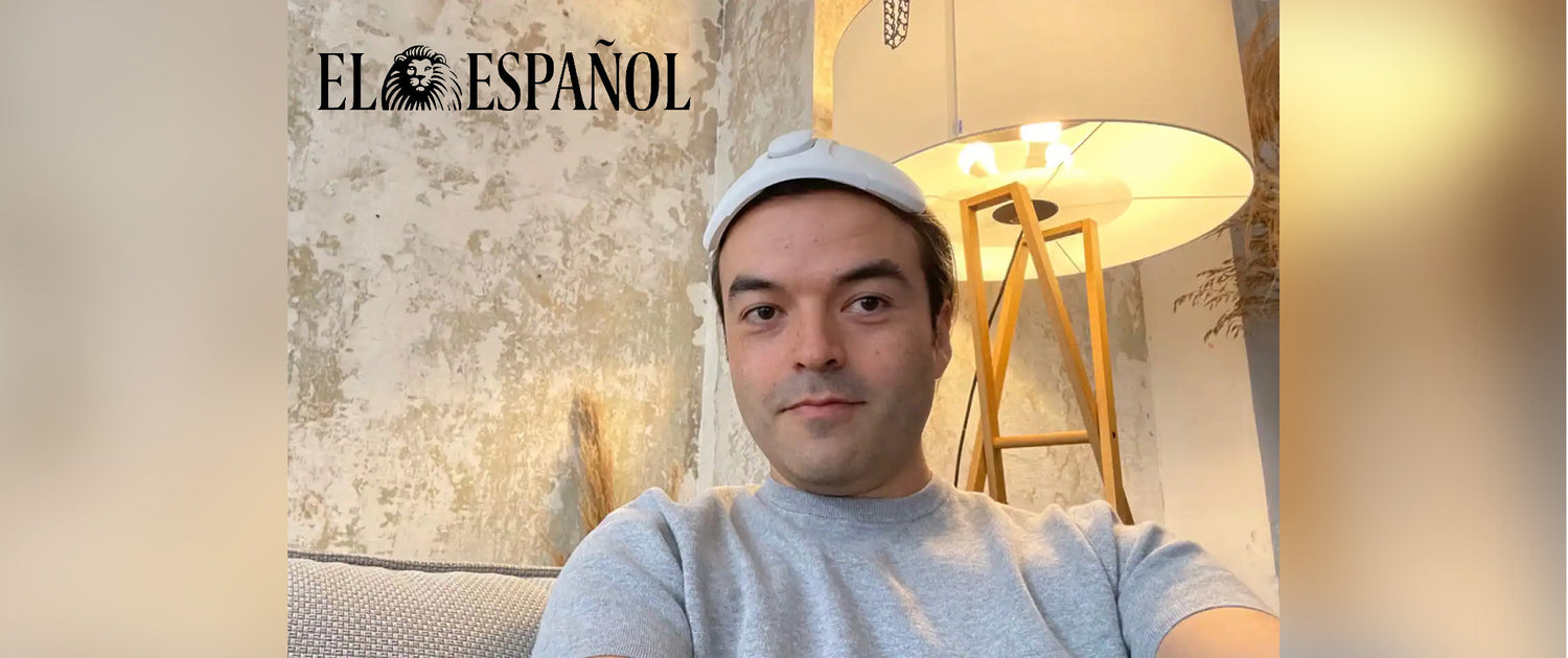 El exitoso invento de Carlos contra la calvicie: promete revertir la pérdida de pelo en 6 meses